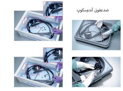 شستشوی آندوسکوپ