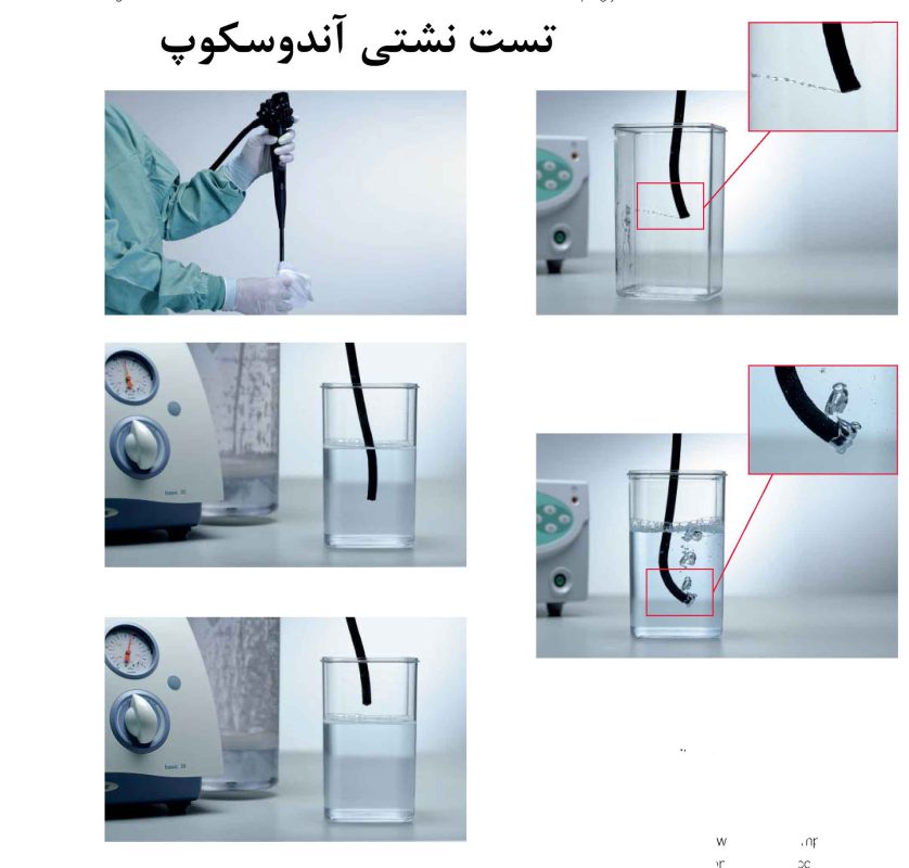 تست نشتی آندوسکوپ