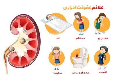 پیشگیری از عفونت ادراری وابسته به کاتتر