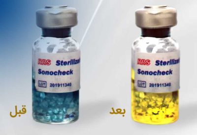 آزمون معتبر سازی سونو چک