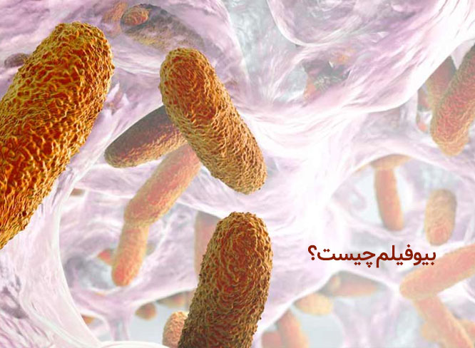 بیوفیلم چیست
