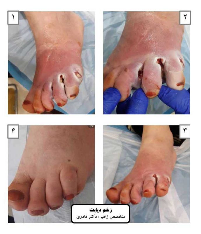 ضدعفونی کننده زخم فارمیسل